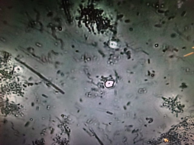 びっくりするもの