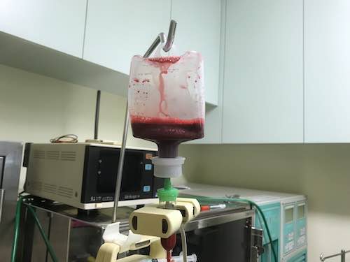 輸血の様子