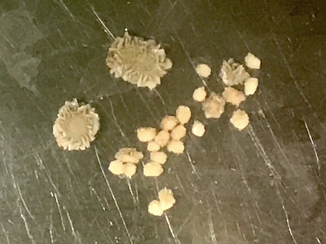 膀胱結石とは何ですか?