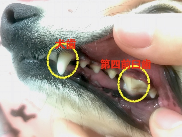 歯列の説明