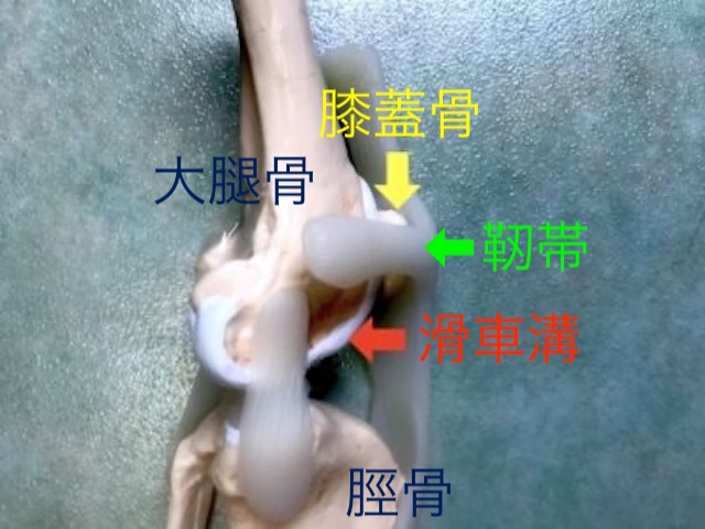 膝蓋骨脱臼の症状