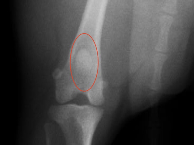 膝蓋骨の位置