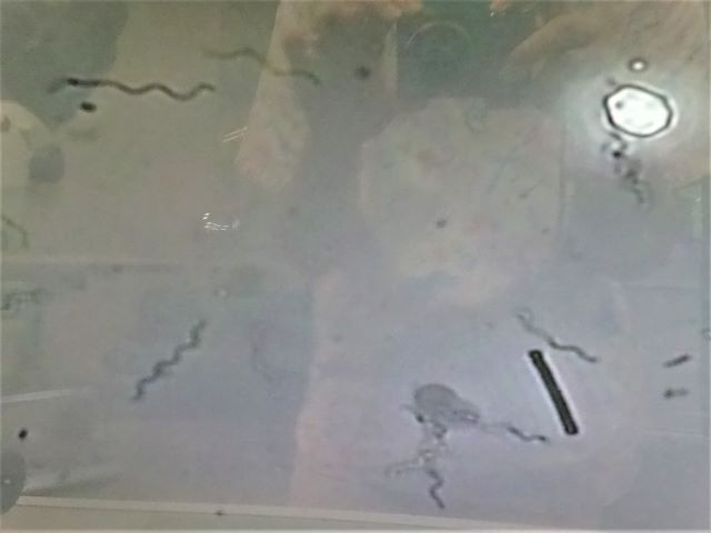 実はうつるんです…！