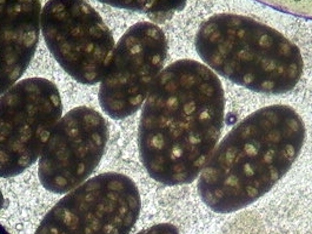 条虫症はどうすれば予防できるのでしょうか?