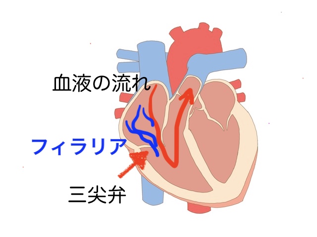 心臓の異常からの浮腫や腹水