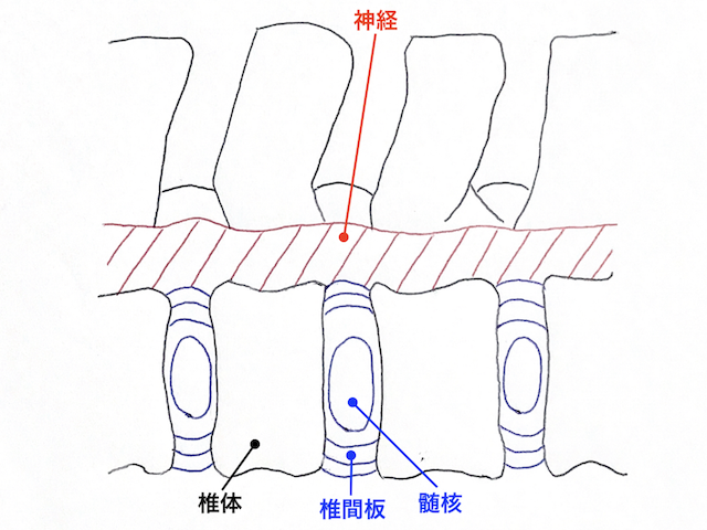 腰の痛み